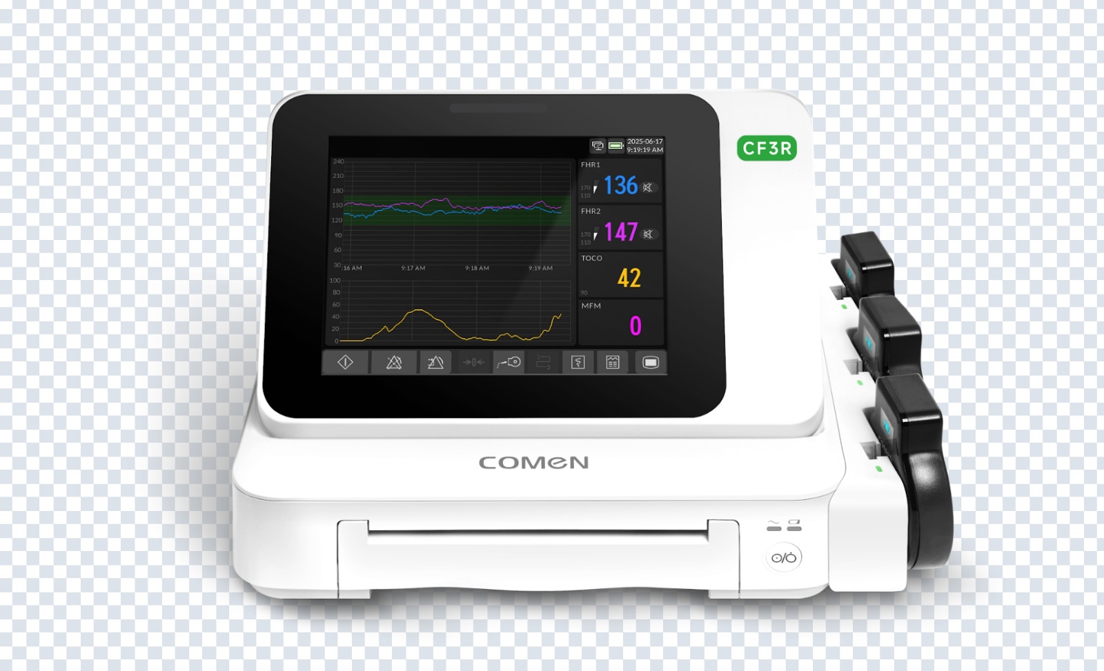 Fetal and Maternal Monitor